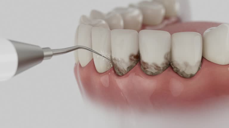 Reliable Dental Implants contractor in Sulligent, AL by Smile Center Dentistry